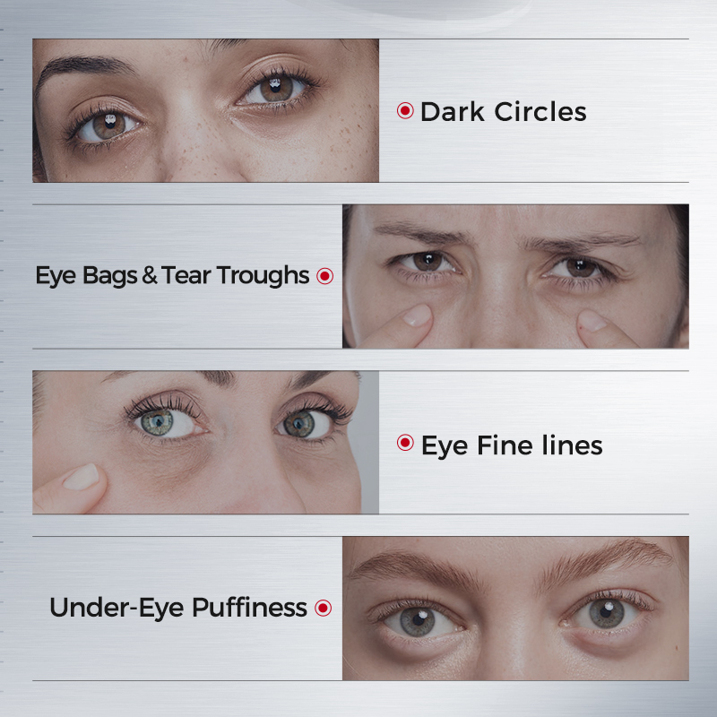 Patches para Olheiras – Firmad - Collagen Eye Patch avaliação e preço