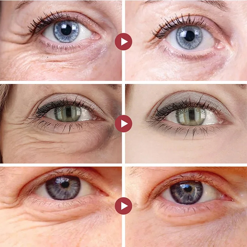 Rugas remover os olhos remendo - Collagen Eye Patch avaliação e preço